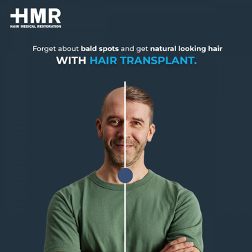 Slider image (3) Hair Medical Restoration (HMR)
